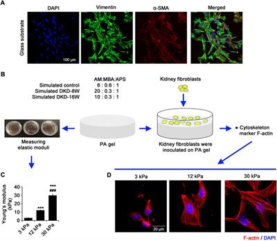 Polydatin attenuates tubulointerstitial fibrosis in diabetic kidney disease by inhibiting YAP expression and nuclear translocation